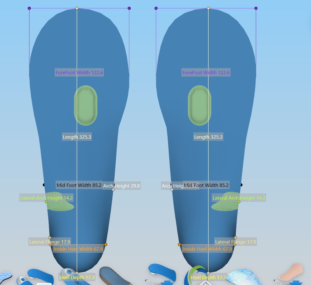 CAD/CAM design of custom orthotics with detailed biomechanical measurements